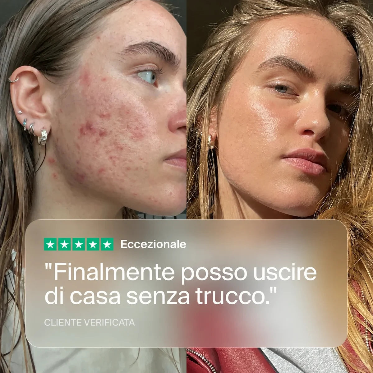 Clear+  Formula Anti-Acne