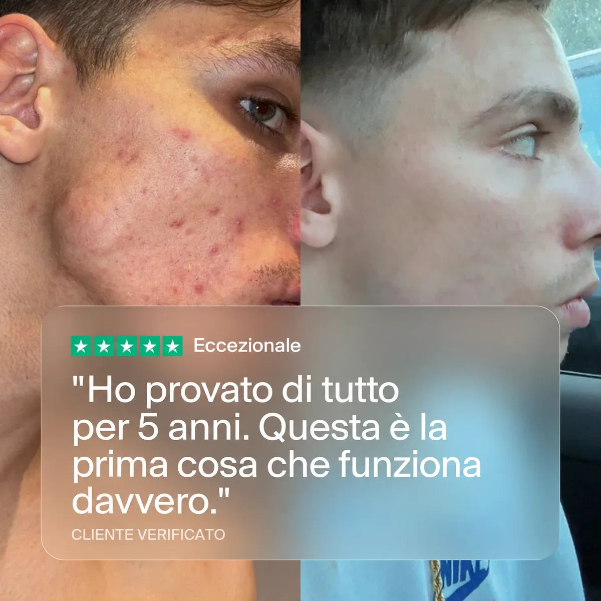 Clear+  Formula Anti-Acne