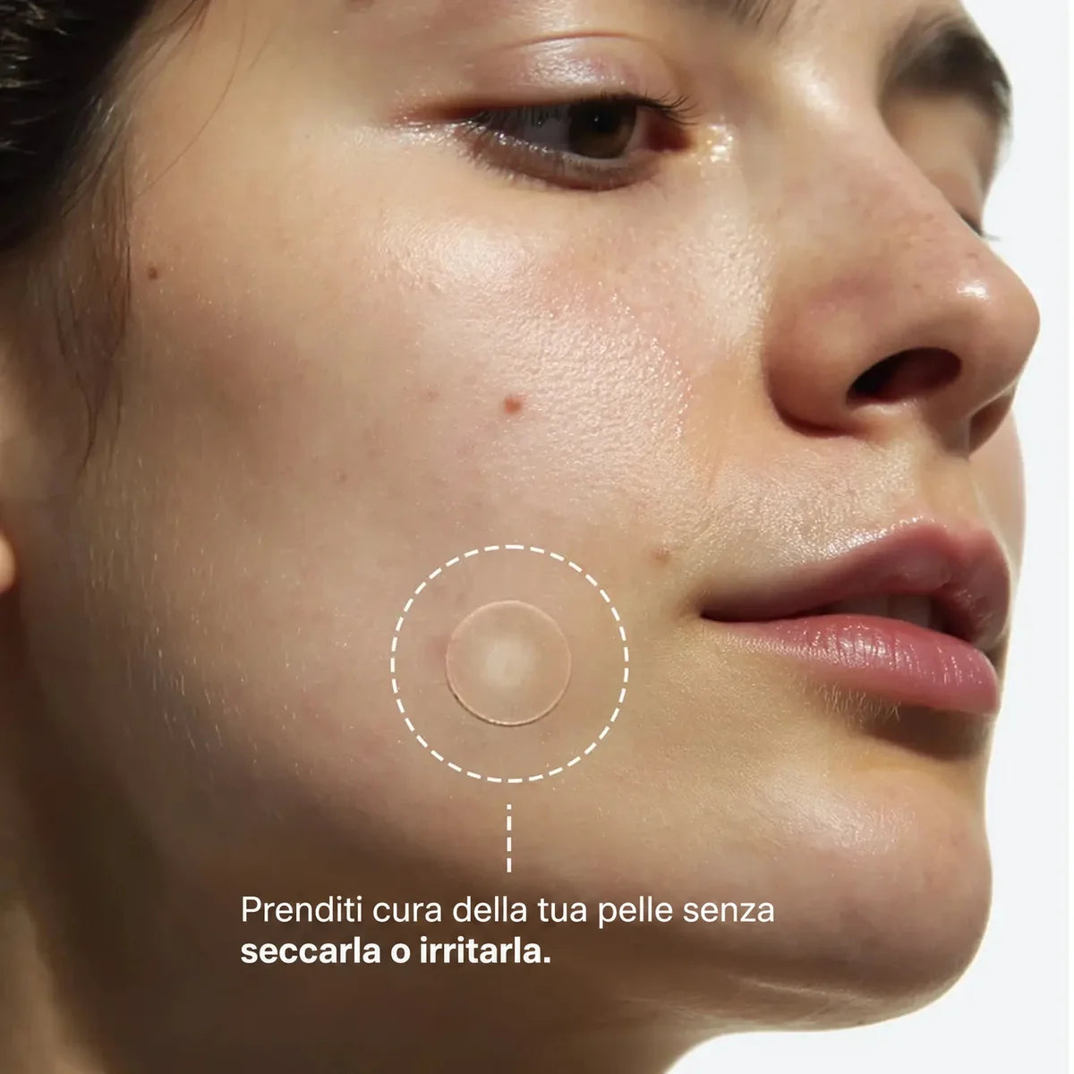 Cerotti Idrocolloidali per Brufoli