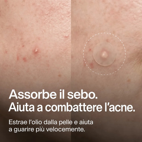 Cerotti Idrocolloidali per Brufoli
